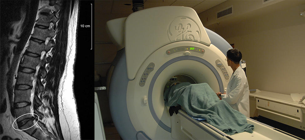 Left picture shows an image of the human spinal column taken using magnetic resonance imaging. Left picture is a photograph of the magnetic resonance imaging instrument.